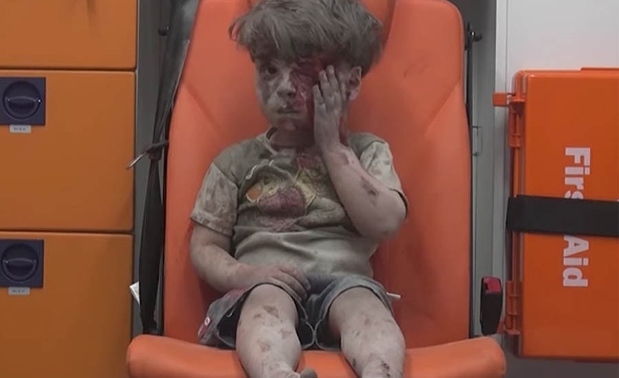 Omran Daqneesh